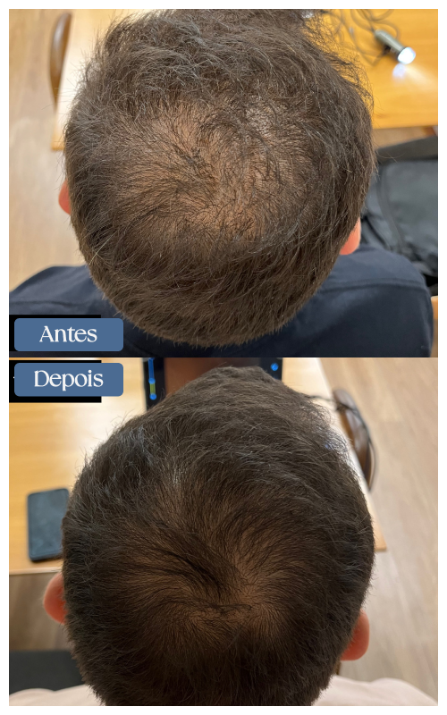 antes e depois (8)
